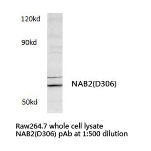 NAB2 (D306) pAb avatar
