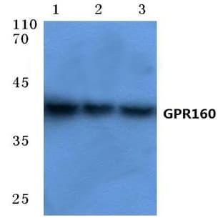 GPR160 (I337) pAb avatar