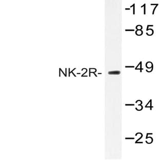 NK-2R (P340) pAb avatar