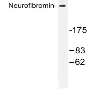 Neurofibromin (R1575) pAb avatar