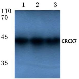 CXCR7 (A356) pAb avatar