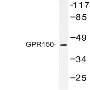 GPR150 (Q391) pAb avatar