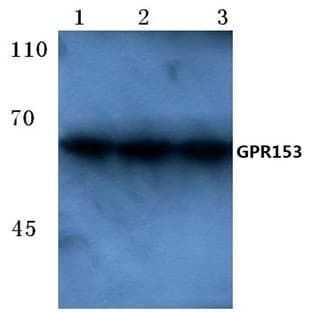 GPR153 (E234) pAb avatar