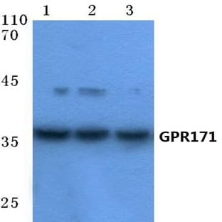 GPR171 (T180) pAb avatar