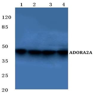 ADORA2A (Y361) pAb avatar