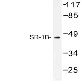 SR-1B (M305) pAb avatar