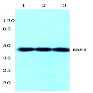 BRS-3 (C203) pAb