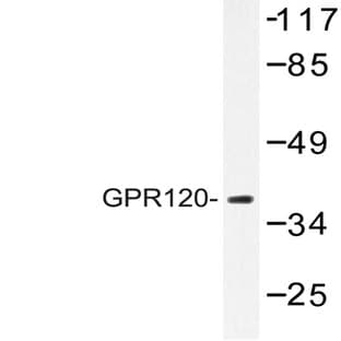 GPR120 (V259) pAb avatar