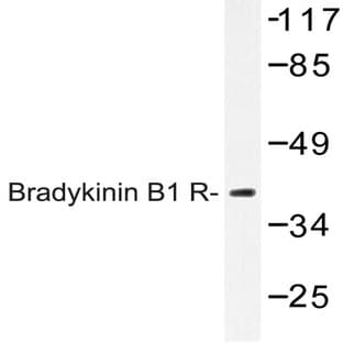Bradykinin B1 R (R239) pAb avatar