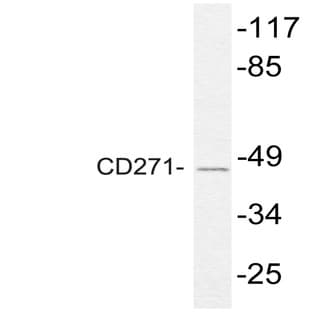 NGFR p75 (K279) pAb avatar