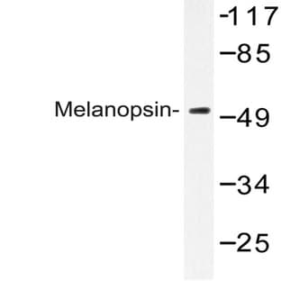 Melanopsin (L470) pAb avatar