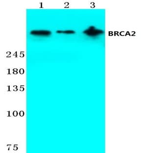 BRCA2 (N60) pAb avatar