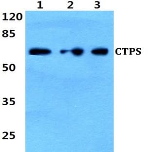 CTPS (K109) pAb avatar
