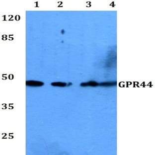 GPR44 (D113) pAb avatar