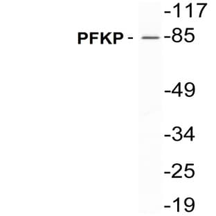 PFKP (E369) pAb avatar
