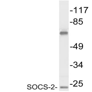 SOCS-2 (E67) pAb avatar