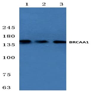 BRCAA1 (D810) pAb avatar