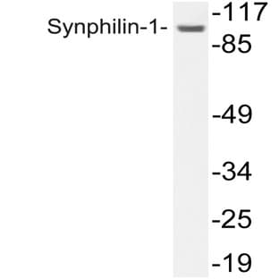 Synphilin-1 (R846) pAb avatar