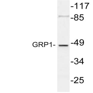 GRP1 (K400) pAb