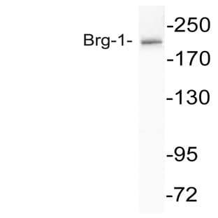 SMARCA4 (R1614) pAb avatar