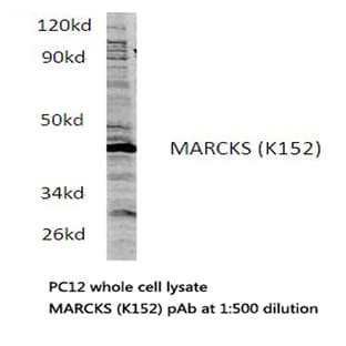 MARCKS (K152) pAb avatar