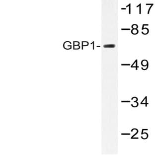 GBP1 (E99) pAb avatar