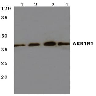 AKR1B1 (K275) pAb avatar