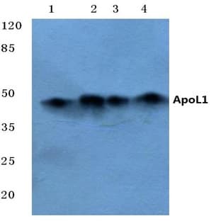 ApoL1 (Q294) pAb avatar