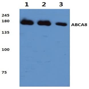 ABCA8 (F1195) pAb avatar