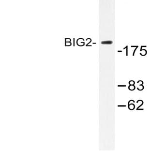 BIG2 (L1527) pAb avatar