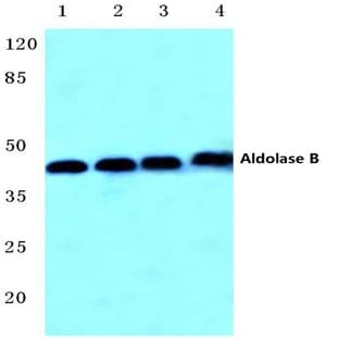 Aldolase B (W148) pAb avatar