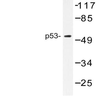 p53 (G372) pAb