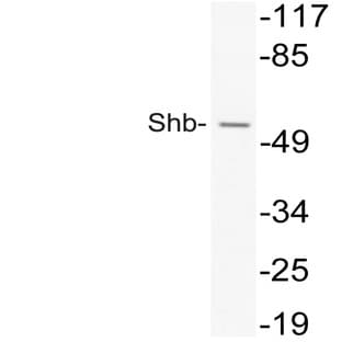 Shb (V240) pAb avatar