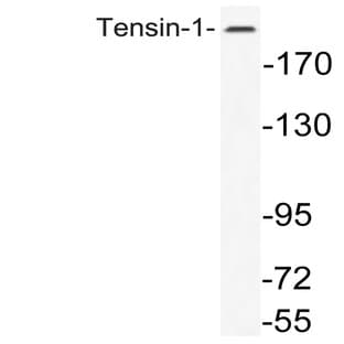 Tensin-1 (A1322) pAb avatar