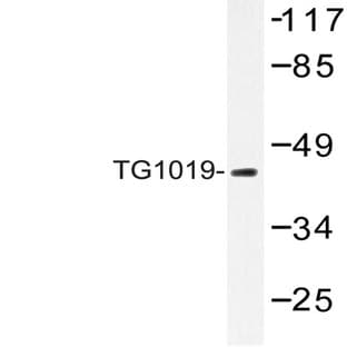 TG1019 (R251) pAb avatar