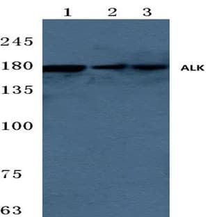 ALK (W1503) pAb avatar