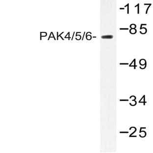 PAK4/5/6 (V469) pAb avatar