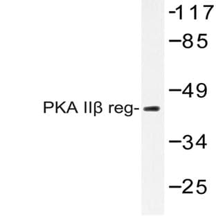 PKA II(beta) reg (T109) pAb avatar