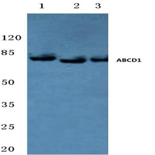 ABCD1 (D575) pAb avatar