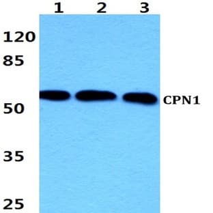 CPN1 (Q452) pAb avatar