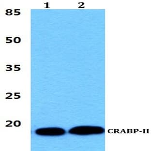 CRABP-II (P81) pAb avatar