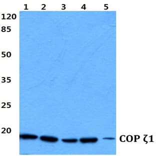 COP ?1 (I48) pAb avatar