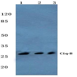 C1q-B (V193) pAb avatar