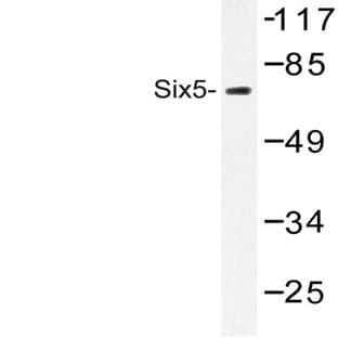 Six5 (L237) pAb avatar