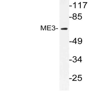 ME3 (R576) pAb avatar