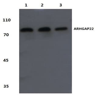 ARHGAP22 (R595) pAb avatar