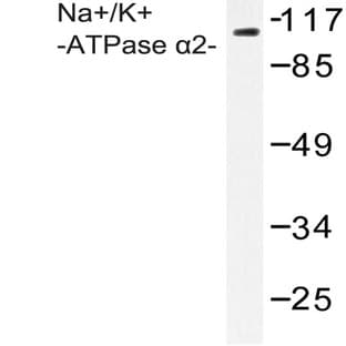 Na+/K+-ATPase (alpha)2 (R1007) pAb avatar