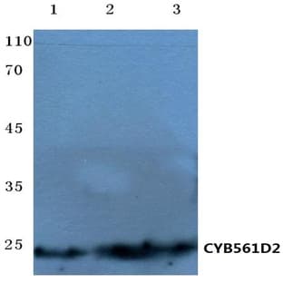 CYB561D2 (H86) pAb avatar