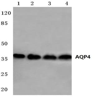 AQP4 (P253) pAb avatar