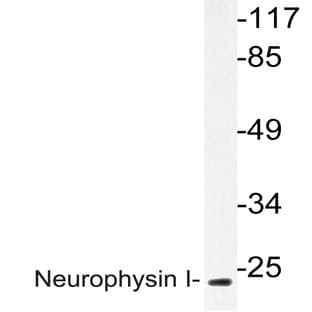 Neurophysin I (K40) pAb avatar